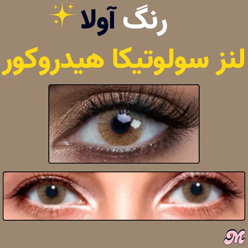 خرید رنگ اولا لنز سولوتیکا هیدروکور قهوه ای ته زمینه زرد