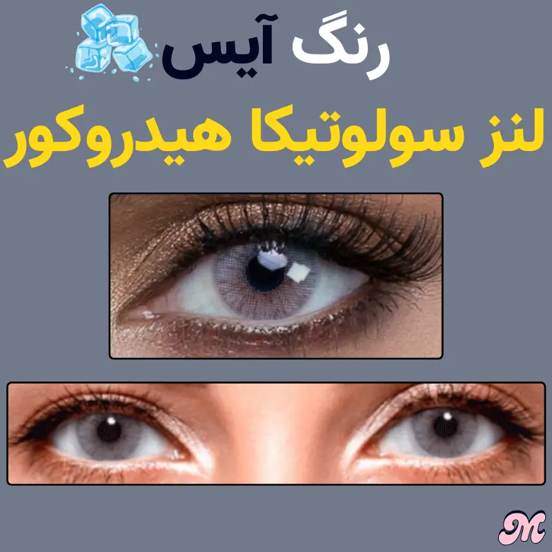 خرید رنگ آیس یخی لنز سولوتیکا هیدروکور رگه های ارغوانی