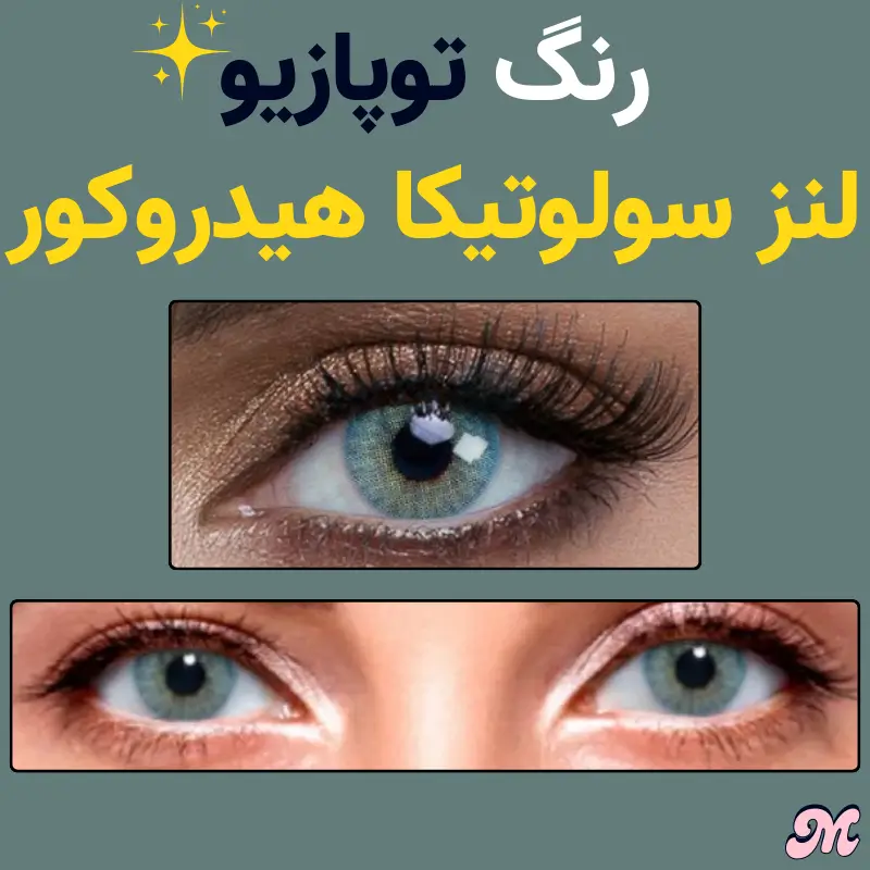 خرید رنگ توپازیو لنز سولوتیکا هیدروکور آبی سبز رگه زرد