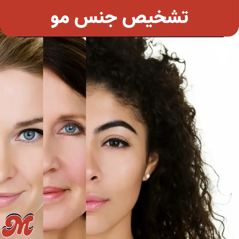 تشخیص جنس مو