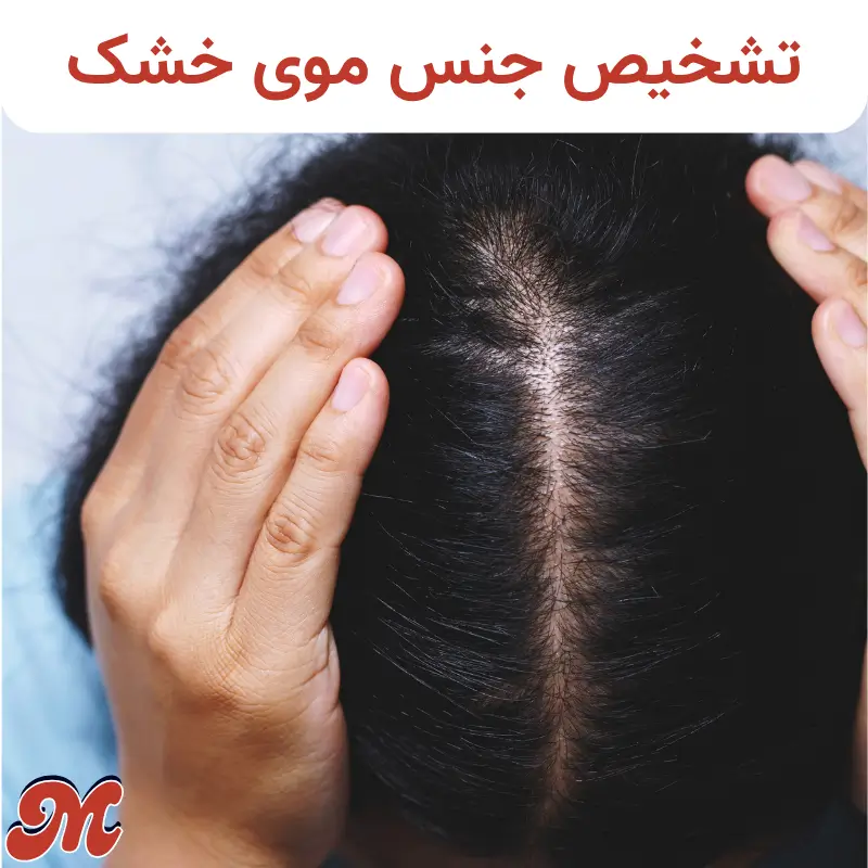 تشخیص جنس موی خشک