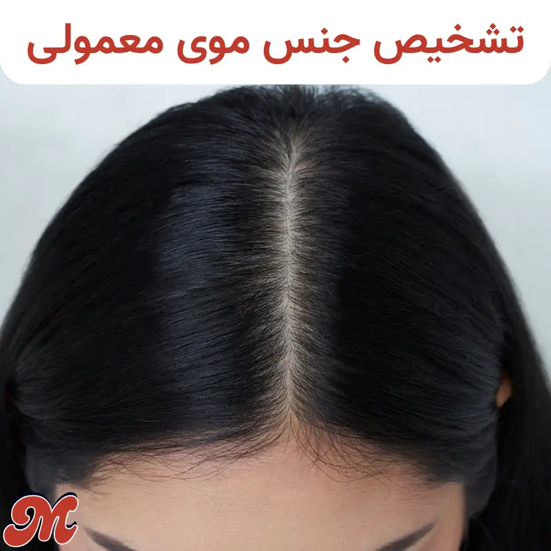 تشخیص جنس موی معمولی