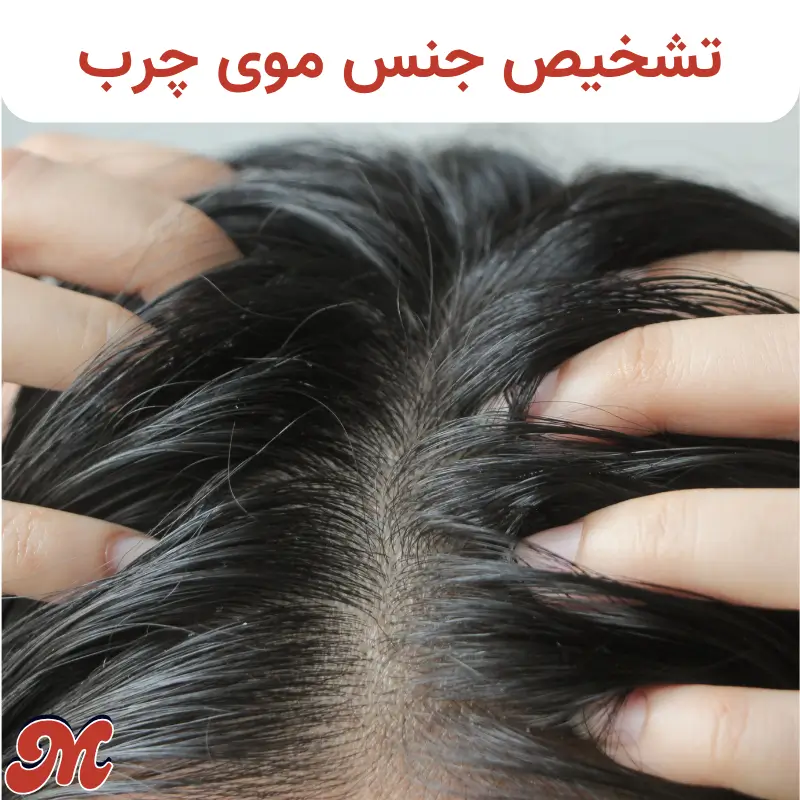 تشخیص جنس موی چرب