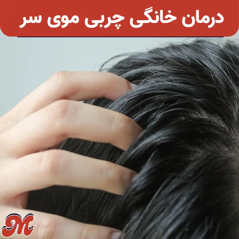 درمان خانگی چربی موی سر