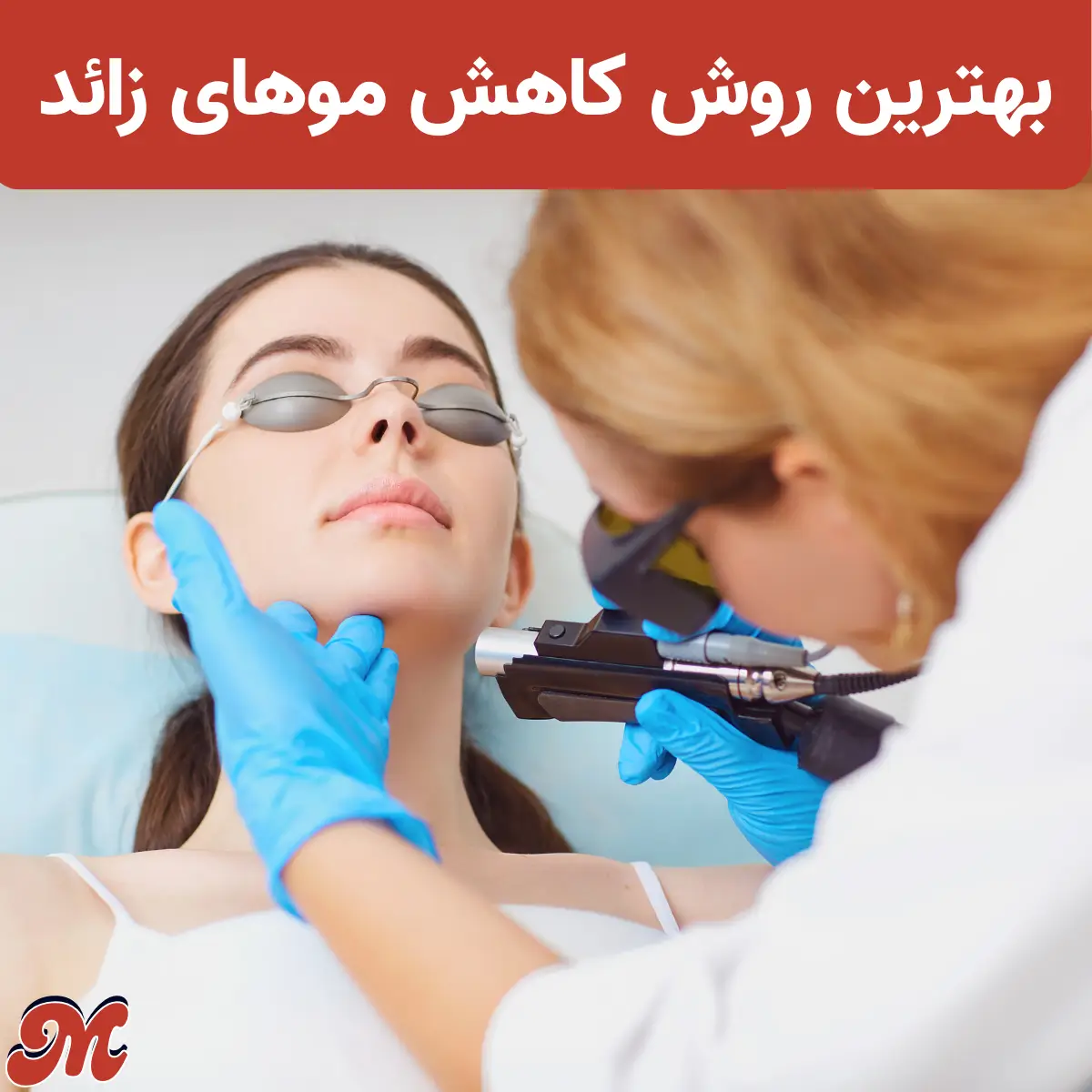 بهترین روش کاهش موهای زائد