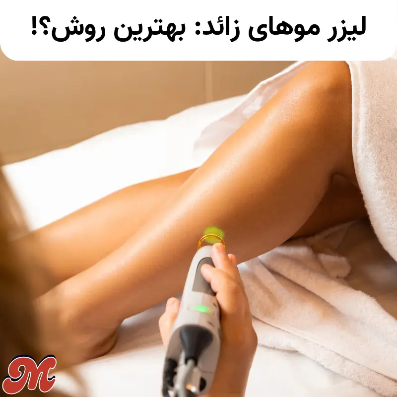 تاثیر لیزر موهای زائد